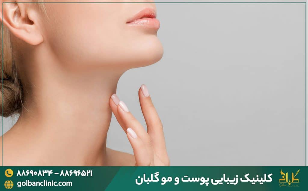لیبو ساکشن غبغب