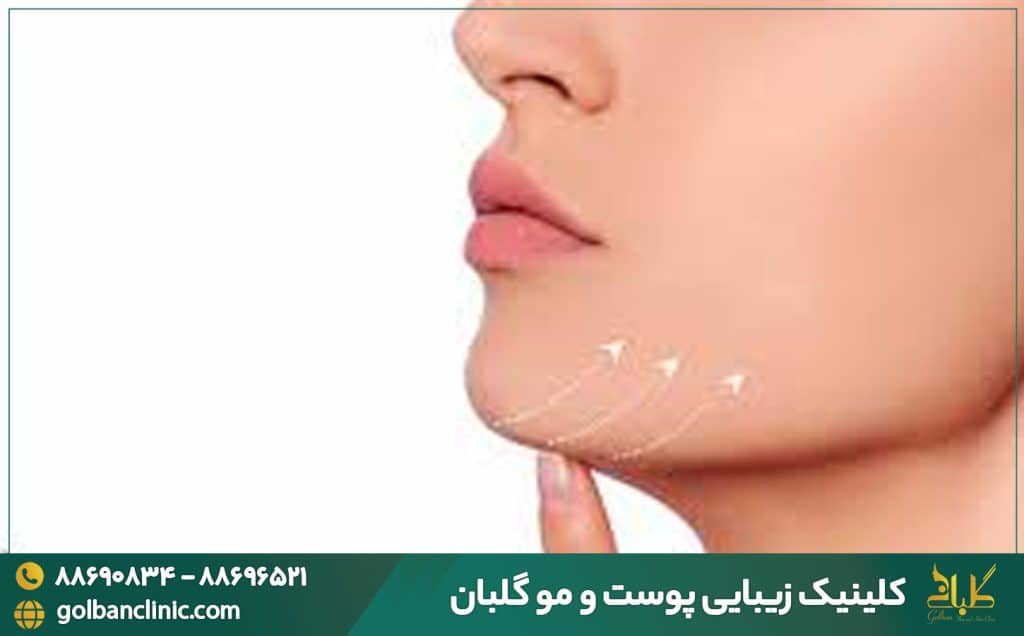 لیبو ساکشن غبغب