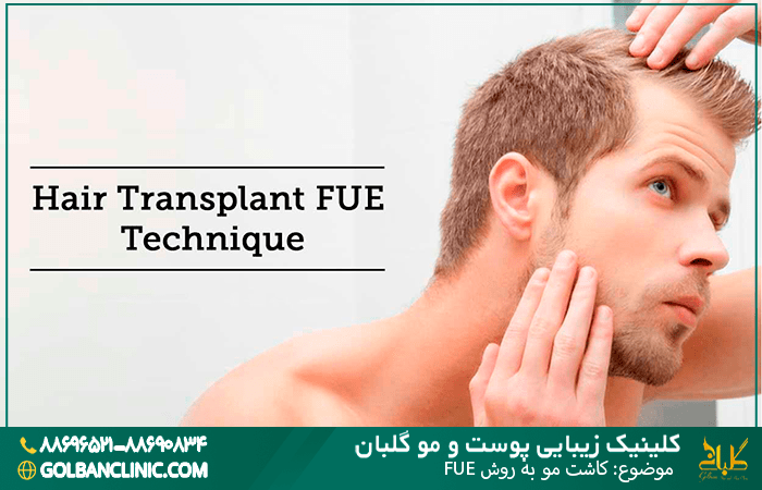 کاشت مو به روش FUE