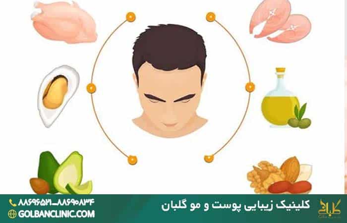 تغذیه بعد از کاشت مو
