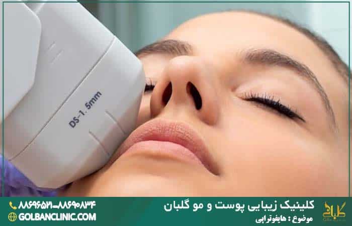 هایفوتراپی در کلینیک گلبان