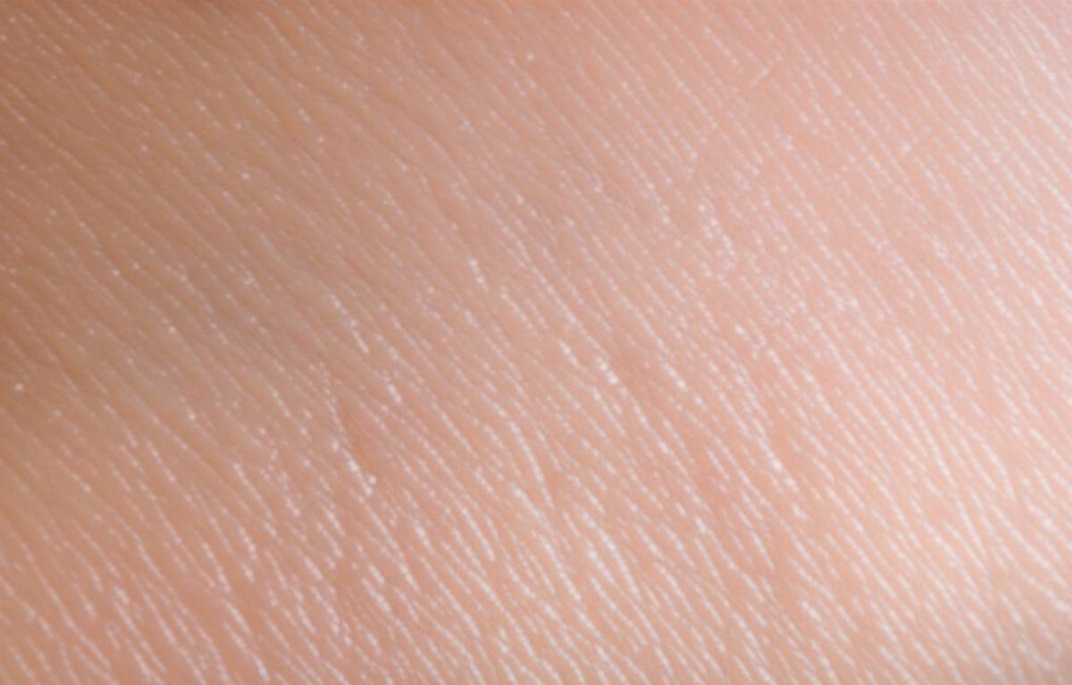 dermatoscope and pre-transplant density